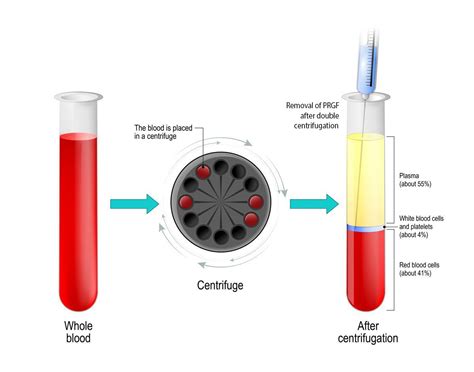 blood centrifuge|blood centrifuge procedure.